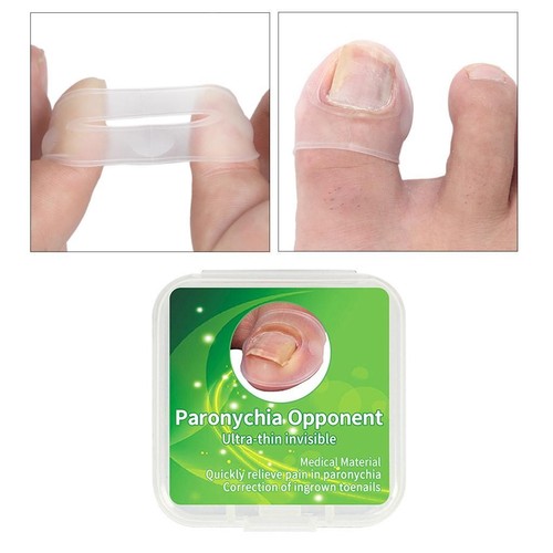 New magideal toe nail - magideal, ingrown